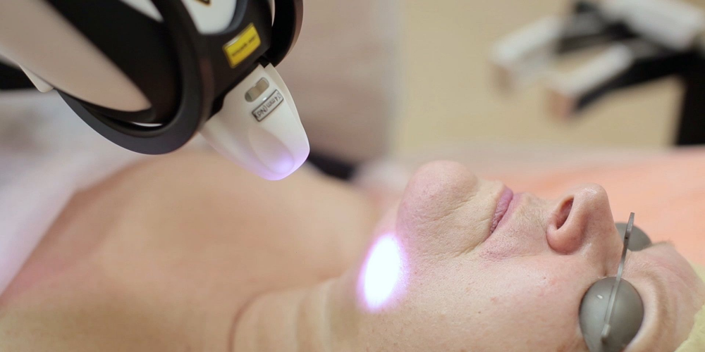 Nd YAP Q-switched Emitter