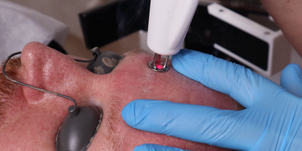 RecoSMA® – A Breakthrough in Laser Regeneration Technology