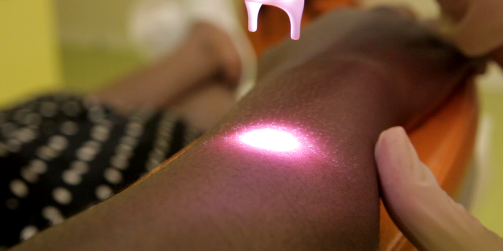 Hair Removal for Any Skin Type (QOOL-epilation®)