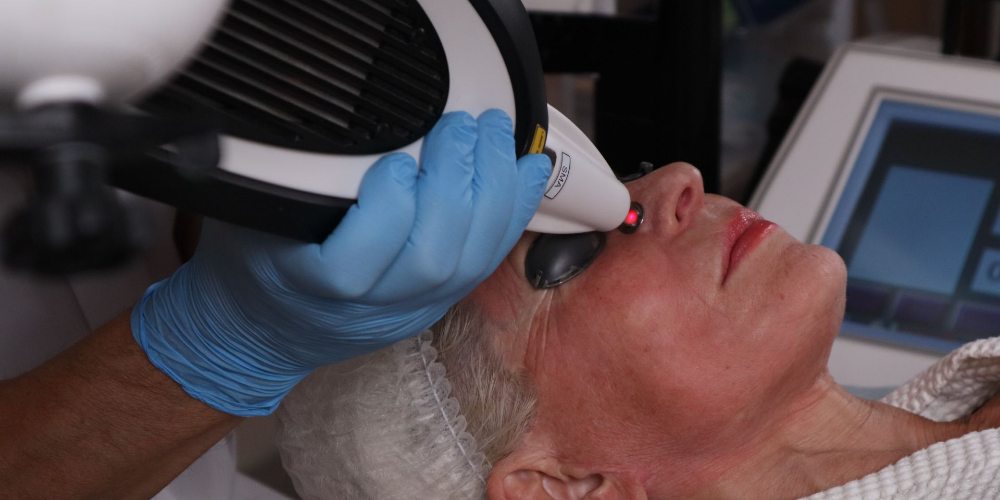 Skin Rejuvenation & Lifting (RecoSMA® on the MULTILINE™ Platform)