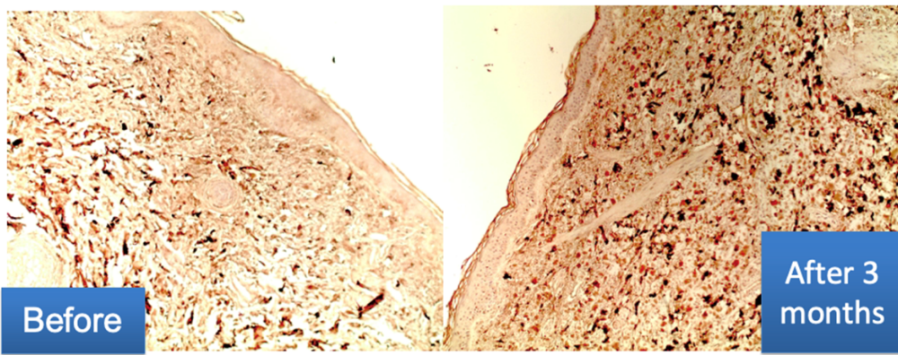 Immunohistochemical examination