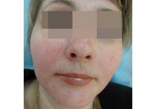 Después de la imagen