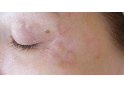 Después de la imagen