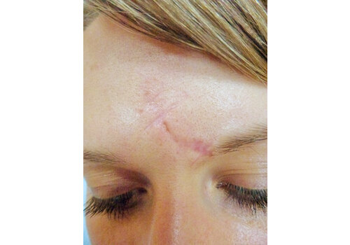 Después de la imagen