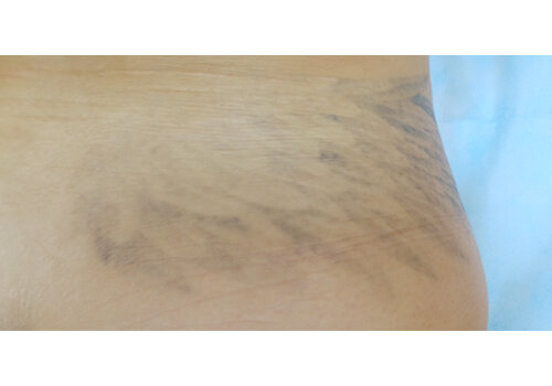 Después de la imagen