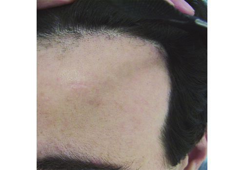 Después de la imagen