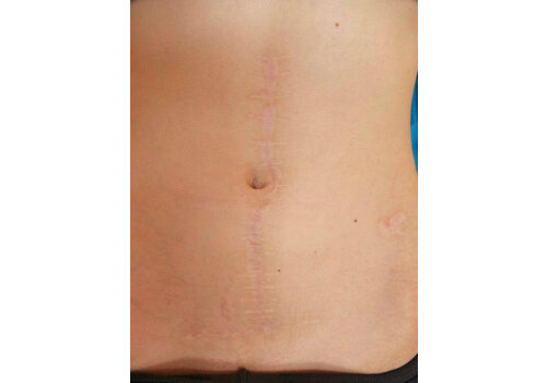 Después de la imagen