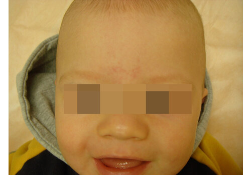 Después de la imagen