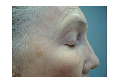 Después de la imagen