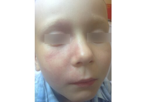 Después de la imagen