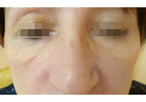 Después de la imagen