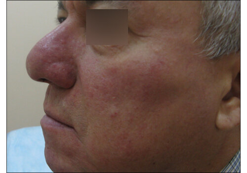 Después de la imagen