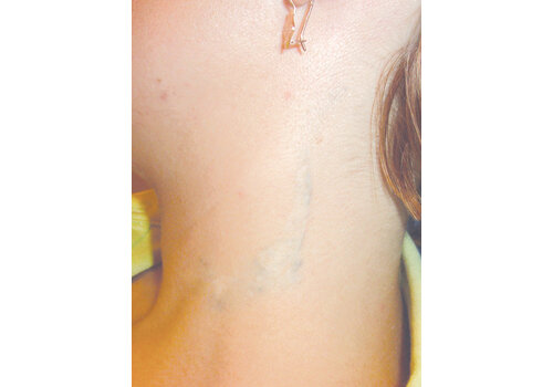 Después de la imagen