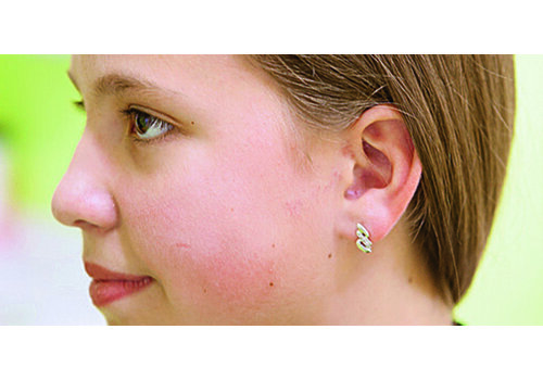 Después de la imagen