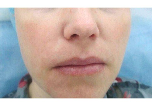 Después de la imagen