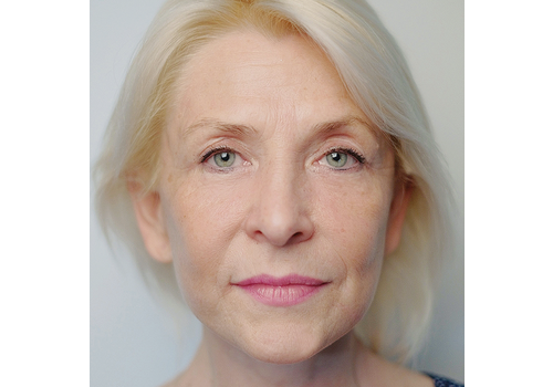 Después de la imagen