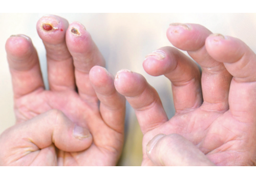 Después de la imagen