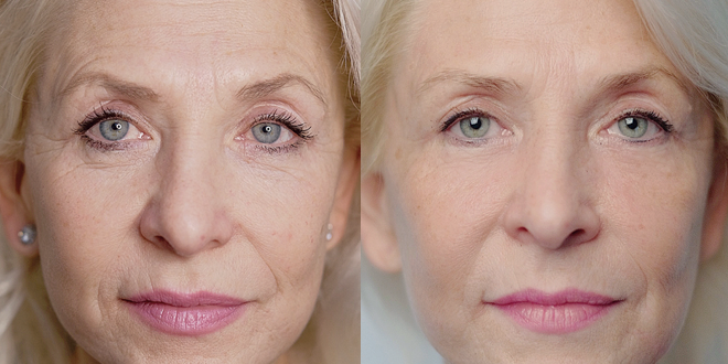 RecoSMA: бьюти-интенсив